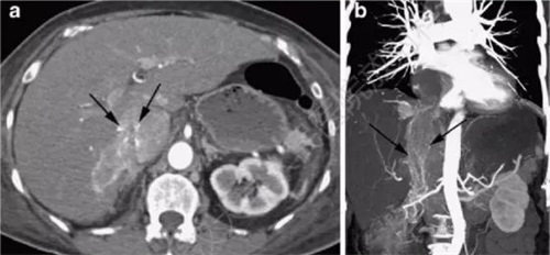 心血管圖像處理軟件